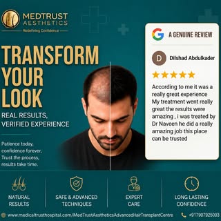 Transform Your Look, Restore Your Confidence

Every successful hair restoration journey begins with 