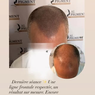 AL PIGMENT
📍Le Havre📍

📞 06.66.41.87.16
🌏 www.al-pigment.fr
📧 contact@al-pigment.fr

✨Micropigm