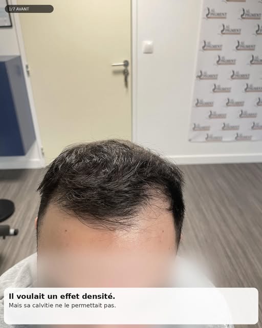 J’ai dit NON à ce client.

Il souhaitait un effet densité pour conserver ses longueurs.

Après analy