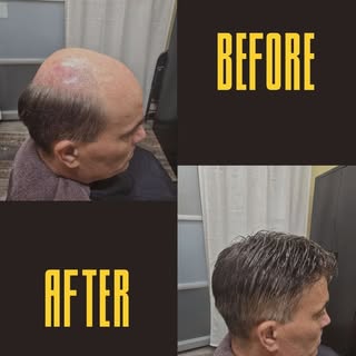Check out this amazing before and after! Check out my link in bio to find your confidence again! Tha