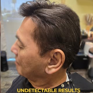 For professionals tired of hiding hair loss.

At Sam Hair Design, every system is customized for:

•
