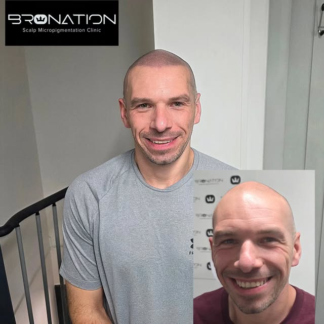 High quality SMP makes a subtle difference to your appearance, but a HUGE difference to your confide