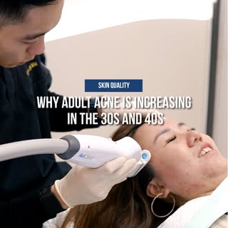 Adult acne in your 30s and 40s is often more complex than teenage acne.

Hormonal changes, stress, o