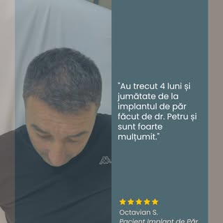 Rezultatele reale vorbesc de la sine.

După doar câteva luni de la implant, transformarea devine viz
