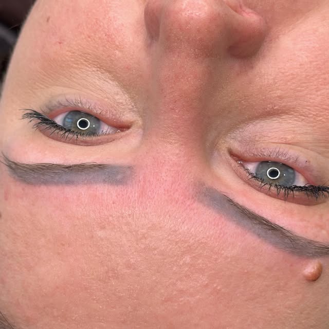 Unele proceduri trebuie sterse ca sa putem face ceva frumos🫶🏻#lasersibiu #micropigmentaresprâncene