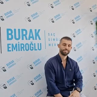 SAÇ SİMÜLASYON UYGULAMASI NEDİR ? 

👉 Saç Simülasyon uygulaması kişinin Saçının Seyrek olan bölgesi