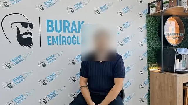 SAÇ SİMÜLASYON UYGULAMASI NEDİR ? 

👉 Saç Simülasyon uygulaması kişinin Saçının Seyrek olan bölgesi