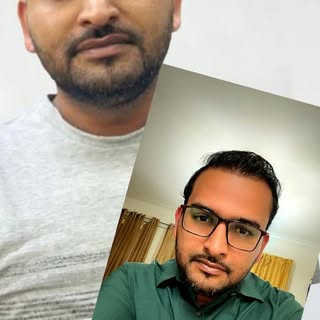 Hair Transplant Before & After

4265 Grafts 7 Months Results

Hair transplant can deliver natural an