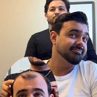 Deixa o seu comentário…
.
859-88103213
.
#prótesecapilar #barba #cabelos
