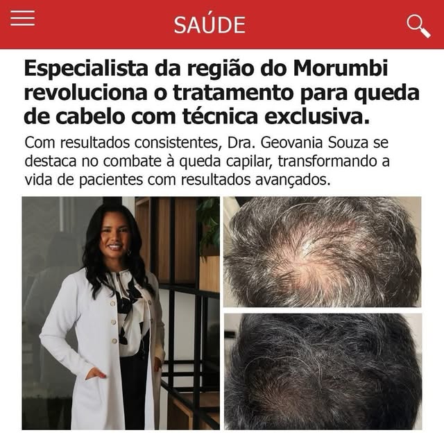 Queda de cabelo não deve ser tratada apenas com a repetição de procedimentos. O primeiro passo é com
