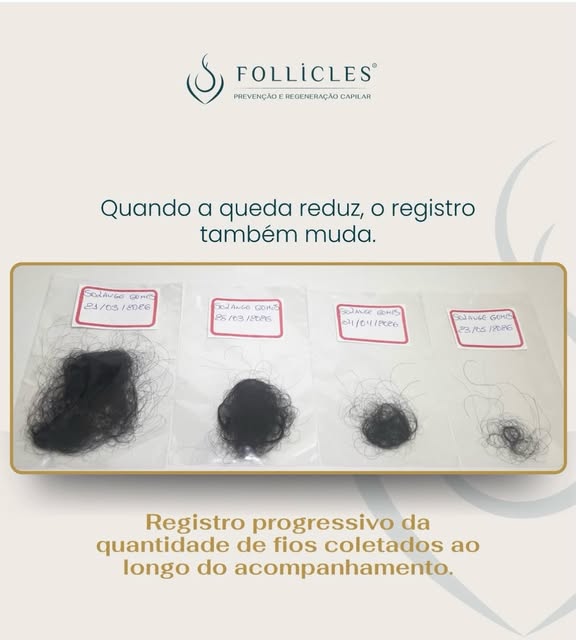 Há evoluções que o espelho, sozinho, não consegue revelar.

Neste caso, a mudança também pôde ser re
