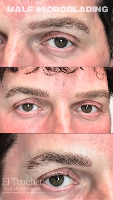 Male Microblading 🔥

Male eyebrows are completely different to female brows. They should never look