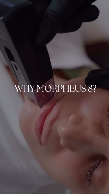 Morpheus8 is where skin tightening meets collagen remodeling. ✨

Using advanced radiofrequency micro