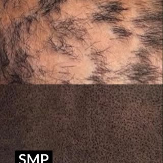 SMP for men and women experiencing hair loss or receding hairlines... plus cosmetic tattoos by a hig