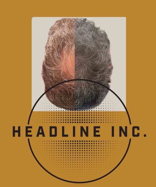 Create the look of thicker hair with Scalp Micropigmentation (SMP). Even when hair is really thinnin