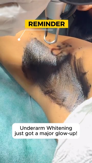 ✨ Brighter Underarms. Smoother Skin. More Confidence. ✨

Dark or uneven underarms can make you consc