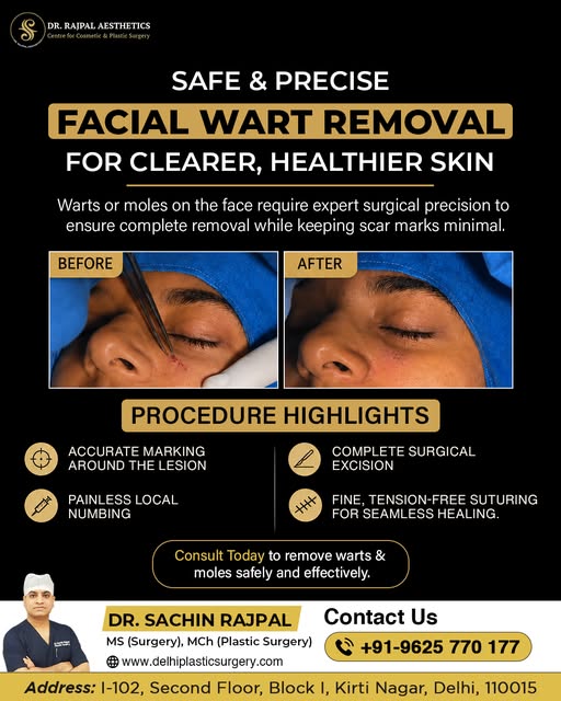 A Facial Wart Can Be Small, But Still Noticeable

A wart on the face may seem like a minor concern, 