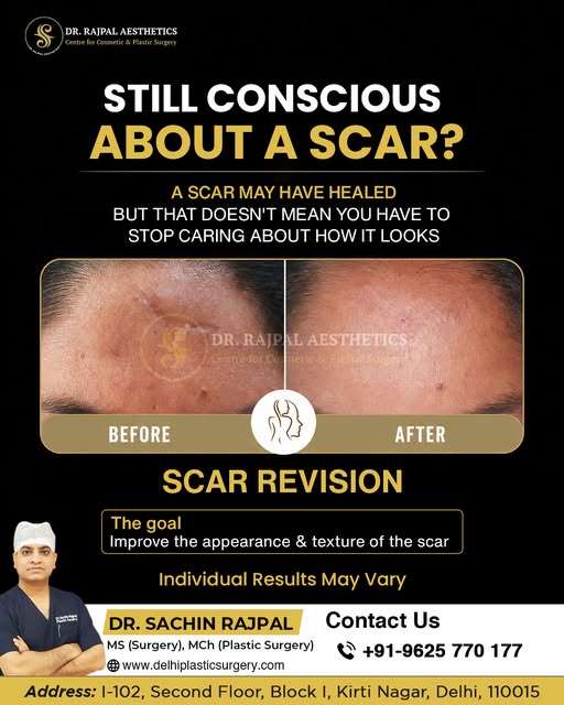 Does a Scar Still Make You Think Twice Before Looking in the Mirror?

A scar can be a reminder of su