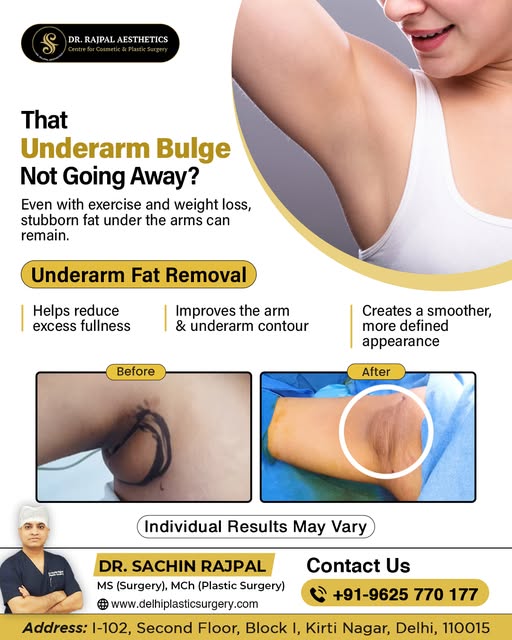 Bulge Under the Arms Even After Losing Weight?

That extra fullness near the underarm area can somet