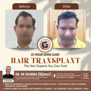 A restored hairline, a renewed sense of confidence. 💯

Transform your look with the trusted hair ex