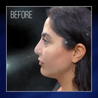 Face Level-Up
فیس «لِول آپ» 
💫 زیباترین و شیکترین نسخه طبیعی چهره 💫 
.
.
.
.
.
.
.
The lipstick ef