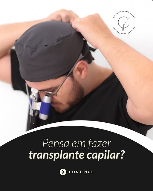 Transplante capilar não é simplesmente preencher onde falta cabelo. É planejar um resultado que cont