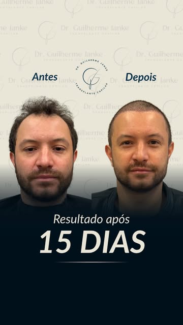 Evolução em 15 Dias!

A decisão de mudar foi o primeiro passo para uma nova fase de confiança e bem-