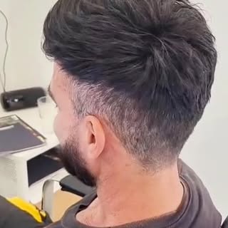 Mit einem professionell angepassten Haarsystem erhältst du in nur wenigen Stunden wieder volles, nat