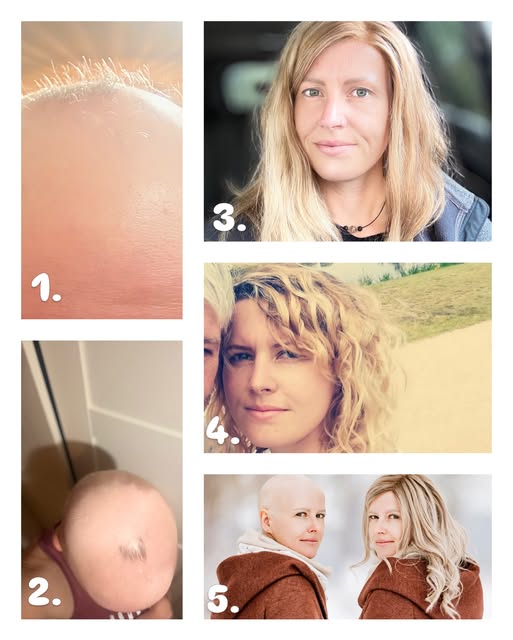 Diese Bilder gehen mir unter die Haut. 🤍 Sie zeigen verschiedene Kapitel meiner Haarreise – von dam
