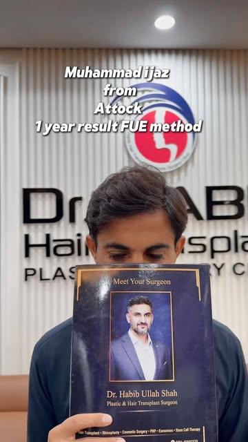 Hairtransplant 1 year incredible ￼result 💯🌟.
.

For booking\more details:0️⃣3️⃣2️⃣5️⃣8️⃣8️⃣0️⃣0️⃣3