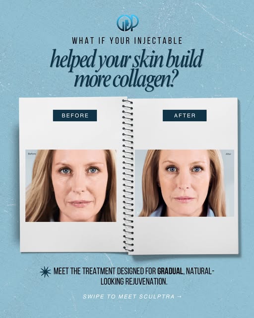 What if your injectable helped your skin do more of the work? 👀✨

Meet Sculptra®—an injectable trea