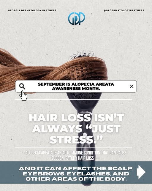 Hair loss isn’t one-size-fits-all, and neither is the treatment. 💙

For Alopecia Areata Awareness M