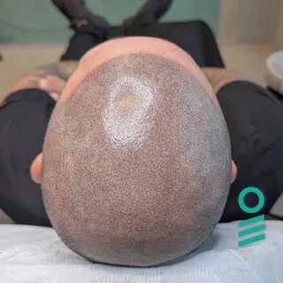 9 YEAR REFRESH!!! Swipe for the before and after! My client told me it's one of the best decisions h