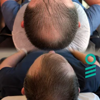 2 sessions down, 1 to go!  Don't spend another year worrying about your hair. Start 2026 off strong,