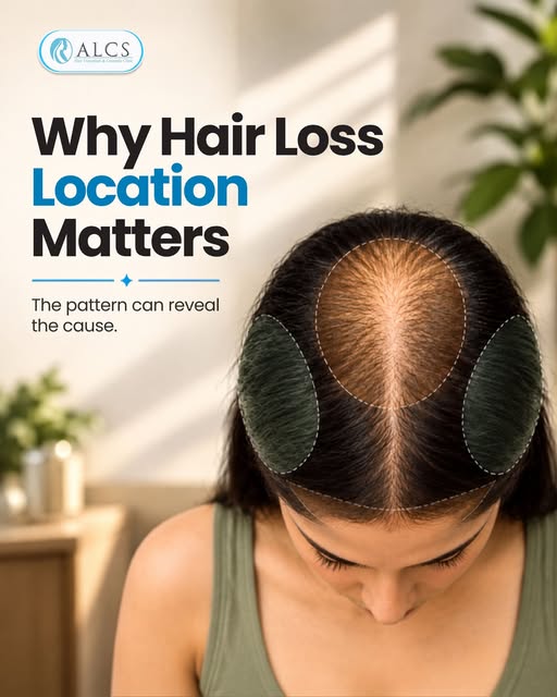 Hair loss ka pattern sirf appearance nahi, cause ka clue bhi deta hai. 🧬✨
Right diagnosis = Right t