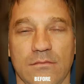 Rhinoplasty specialist | facial reconstructive surgeon, call for a free consultation on 858 623-6333