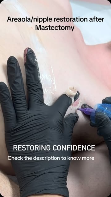 Restoration is so much more than skin deep. 
After undergoing a mastectomy, many brave men and women