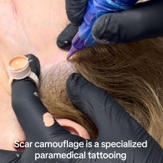 Scar camouflage Romford