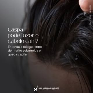 Notou mais fios na escova do que o normal? Isso pode ser um sinal do seu corpo pedindo atenção.

Alg
