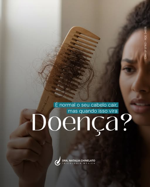 Perder cabelo todos os dias é normal. Em média, caem entre 50 e 100 fios diariamente, e isso faz par