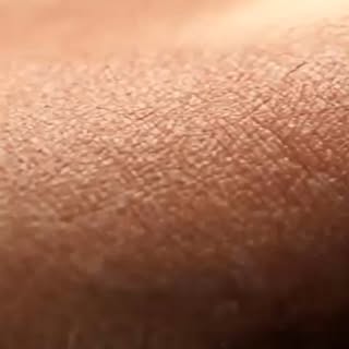 Cildiniz sağlığınızın önemli bir parçasıdır.

 Belirtileri ihmal etmeyin.

 Doğru tanı ve güvenli çö