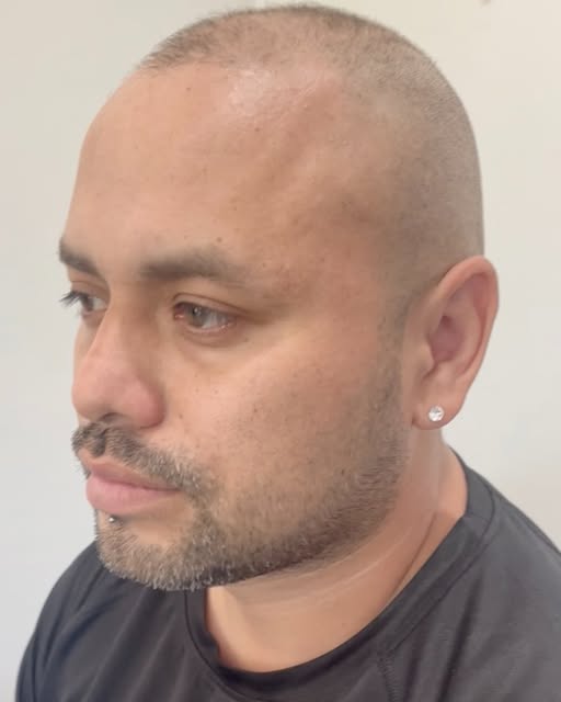 Two sessions. Before, and Healed SMP

Google
⭐⭐⭐⭐⭐
June 15
"Love the results"
-Angel Rodriguez