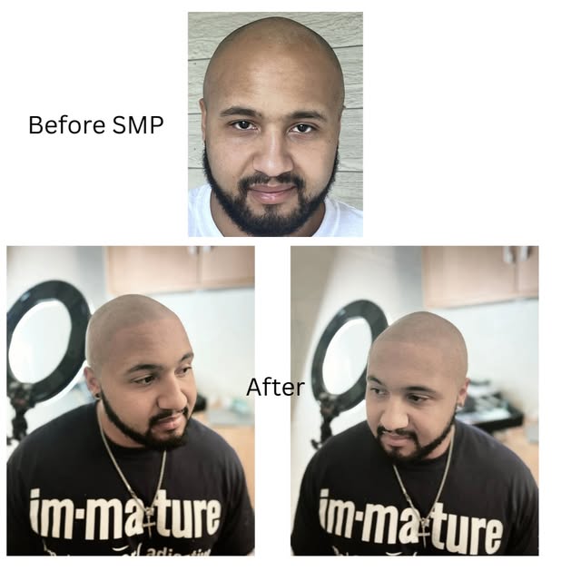 SMP Full Scalp, Session 2, Healed.

Thinking about a full scalp SMP? 

Here is what you need to know
