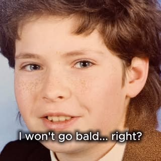 30 years.

8 hair transplants.

More mistakes than I’d like to admit.

When I was in my early 20s, I