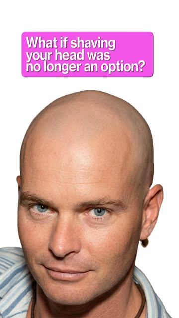 Marc shaved his head for years when he was losing his hair.

For me, that choice disappeared when I 