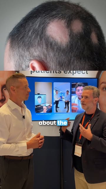 "What did you wish you knew now, that you did not before your Hair Transplant?" answered by @davidan