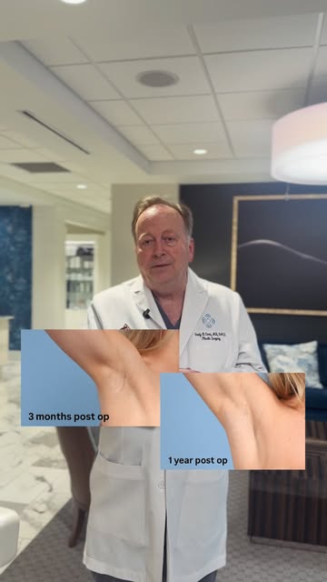 “Why put an incision on the breast when it’s not necessary?” 

Learn more about the trending Balleri