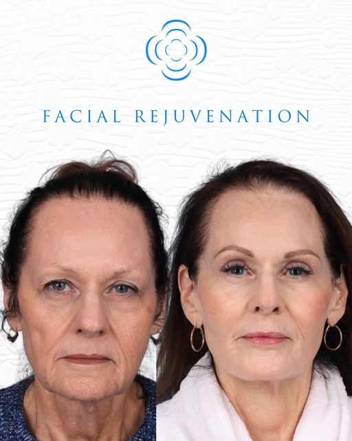 A beautiful result for a happy patient of Dr. Grady Core at Core Plastic Surgery in Birmingham, Alab