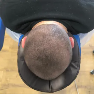 🏆 Une solution à toute épreuve ! La tricotpigmentation capillaire RELOADHAIR c'est bien plus que ré