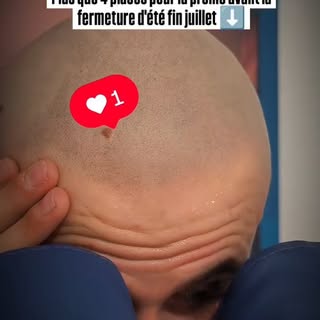 Et si cet été était ton dernier été avec un manque de densité ? Solution capillaire rapide et immédi